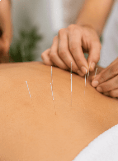 What Conditions Do People Commonly Seek Acupuncture For?