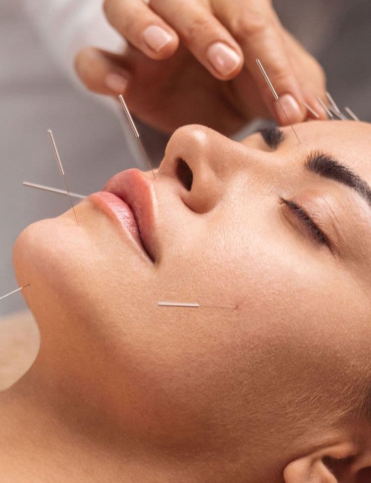 Facial Acupuncture: What You Should Know Before Your First Session