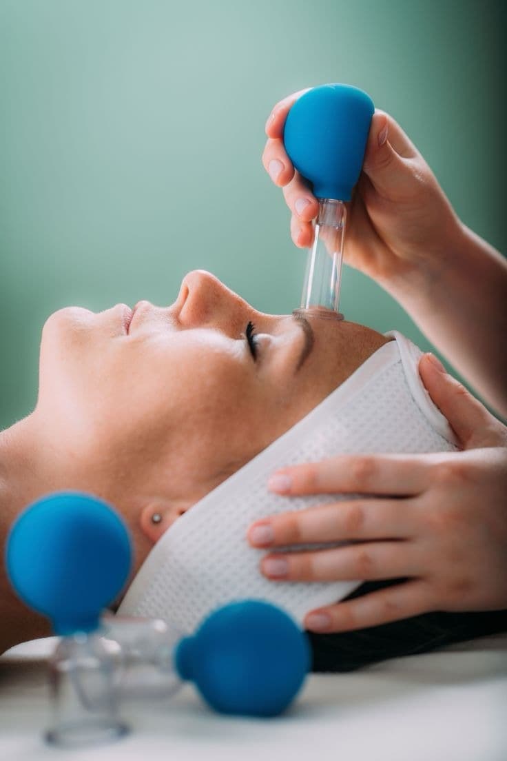 Facial Cupping: What to Expect Before Your First Session